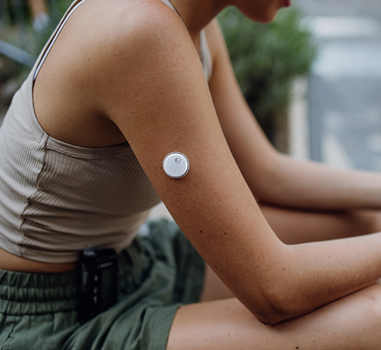 CGM Nedir?